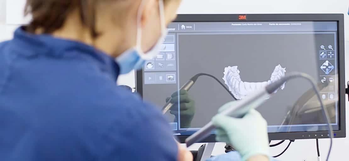 Escáner intraoral dental moderno